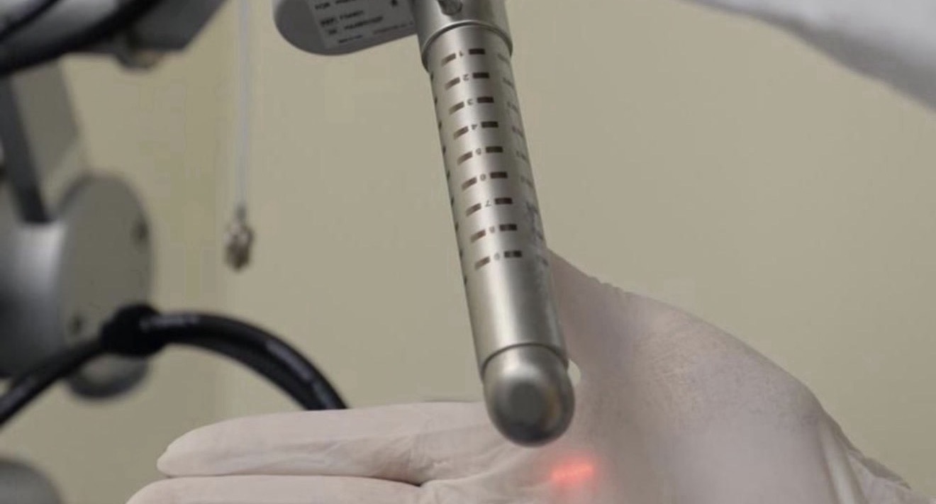 Laser Vaginal Rejuvenation