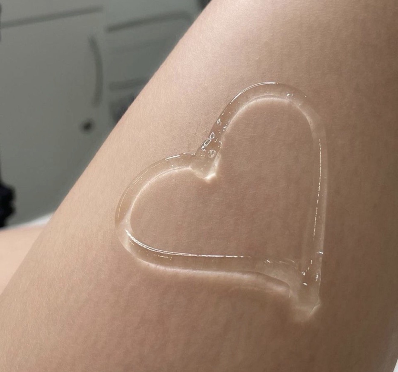 Labia Augmentation with Filler